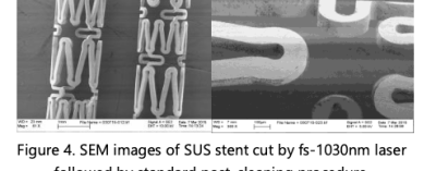 SEM images of SUS stent cut by fs-1030nm laser followed by standard post-cleaning procedure